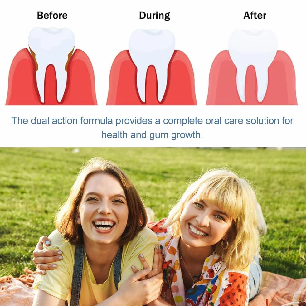 Gengivo Terapia Gel Trattamento Cura Gengive Ricrescita