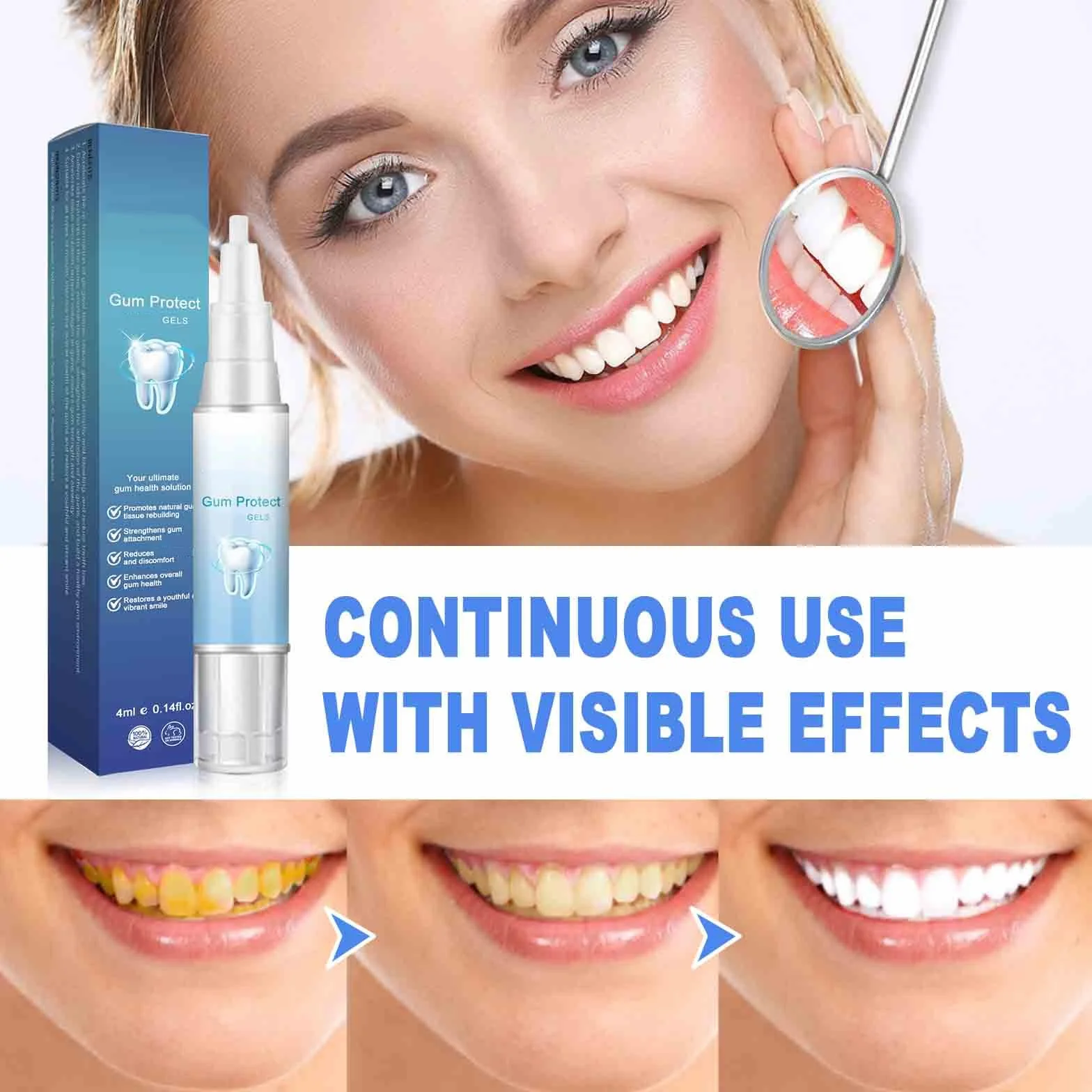 Gel Teeth Whitening Essence Pen, Gum Instant Treatment 4ml