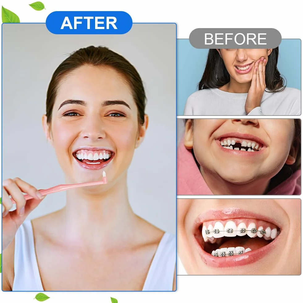 ACWOO Rimozione Tartaro Denti 8 Pezzi Spazzolino Tuft Smacchiatore Denti Professionale Cura Denti