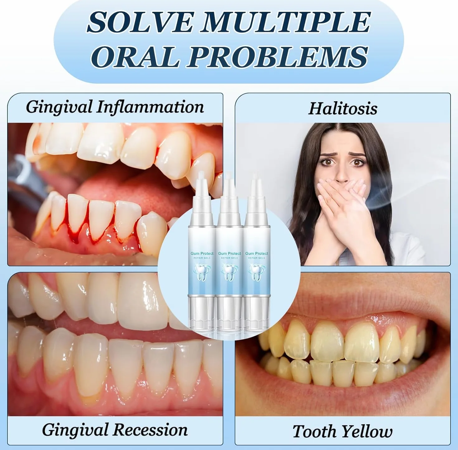 Neslemy Gum Shield Therapy Gel 3-Pack