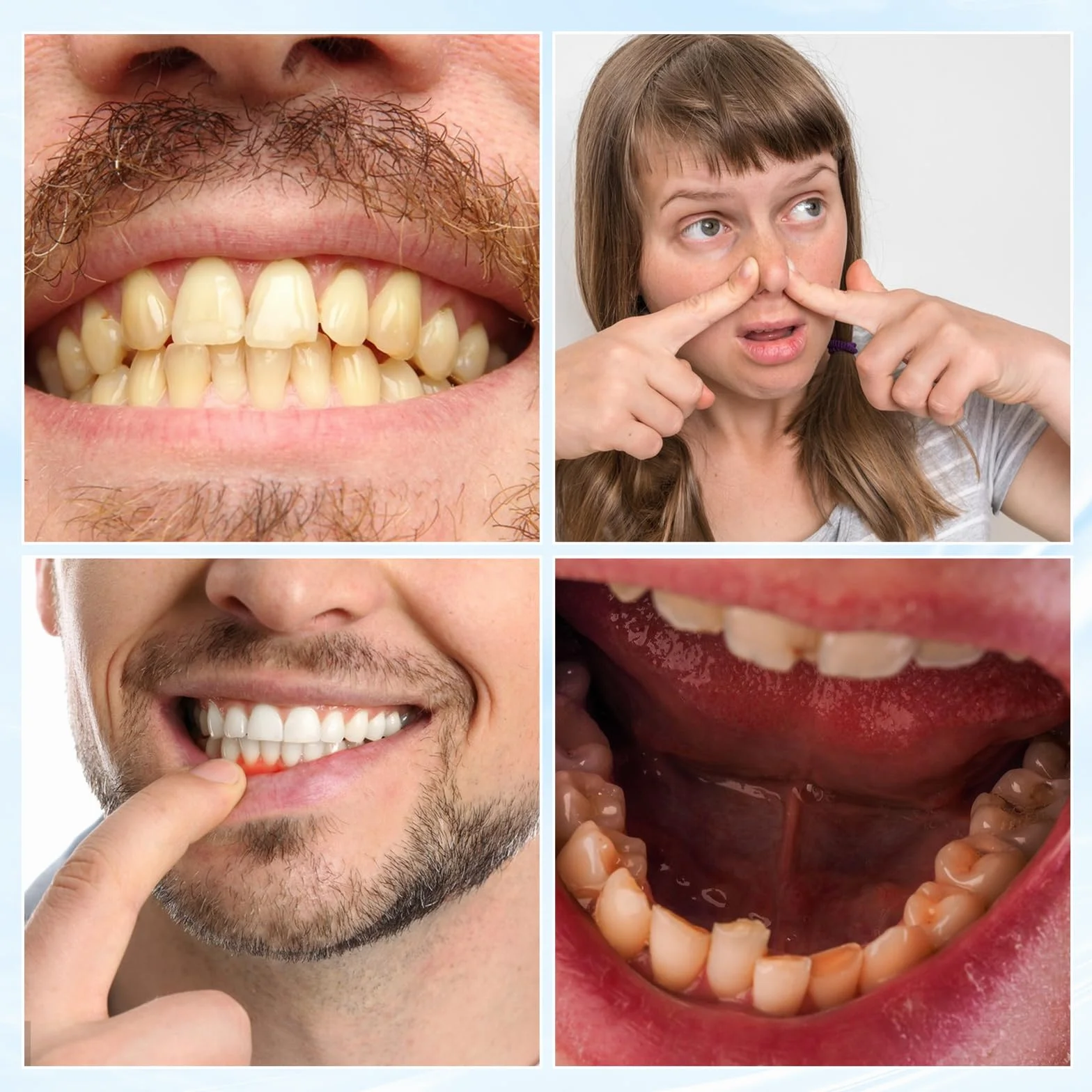 Gel per Terapia Gengivale 3 Pezzi con Scudo Gengivale - Pulizia Profonda Delle Macchie Dei Denti e Del Tartaro