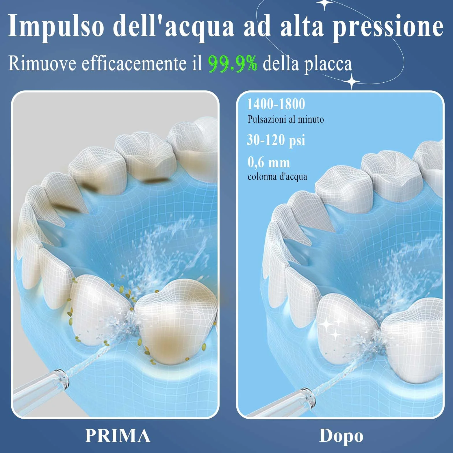 SURFOU Idropulsore Dentale Portatile Professionale Irrigatore Orale Doccia Acqua Getto