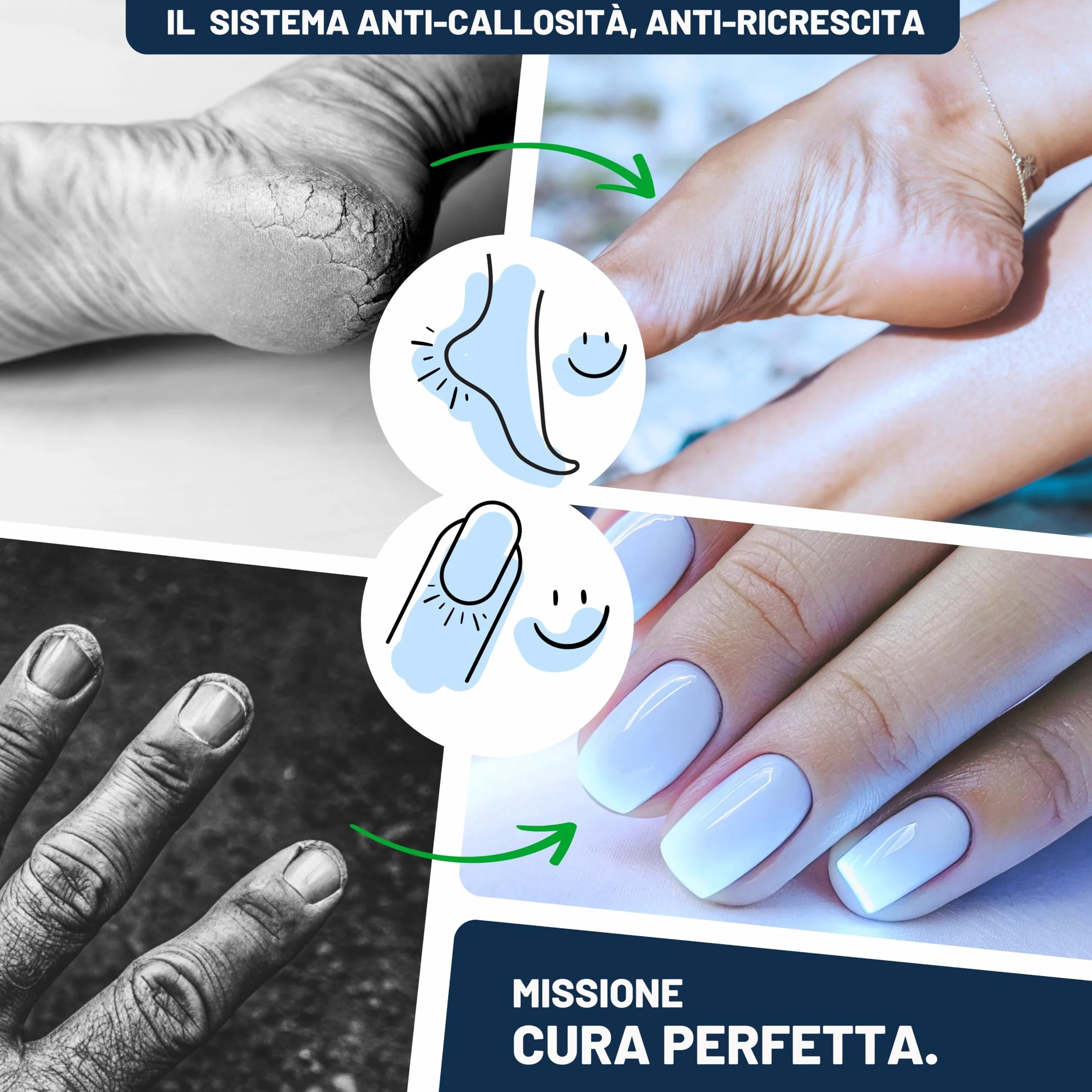 Mr. Fuss Starter Kit 7 pezzi per calli piedi rimozione delicata manicure Sistema Anti-Callosità