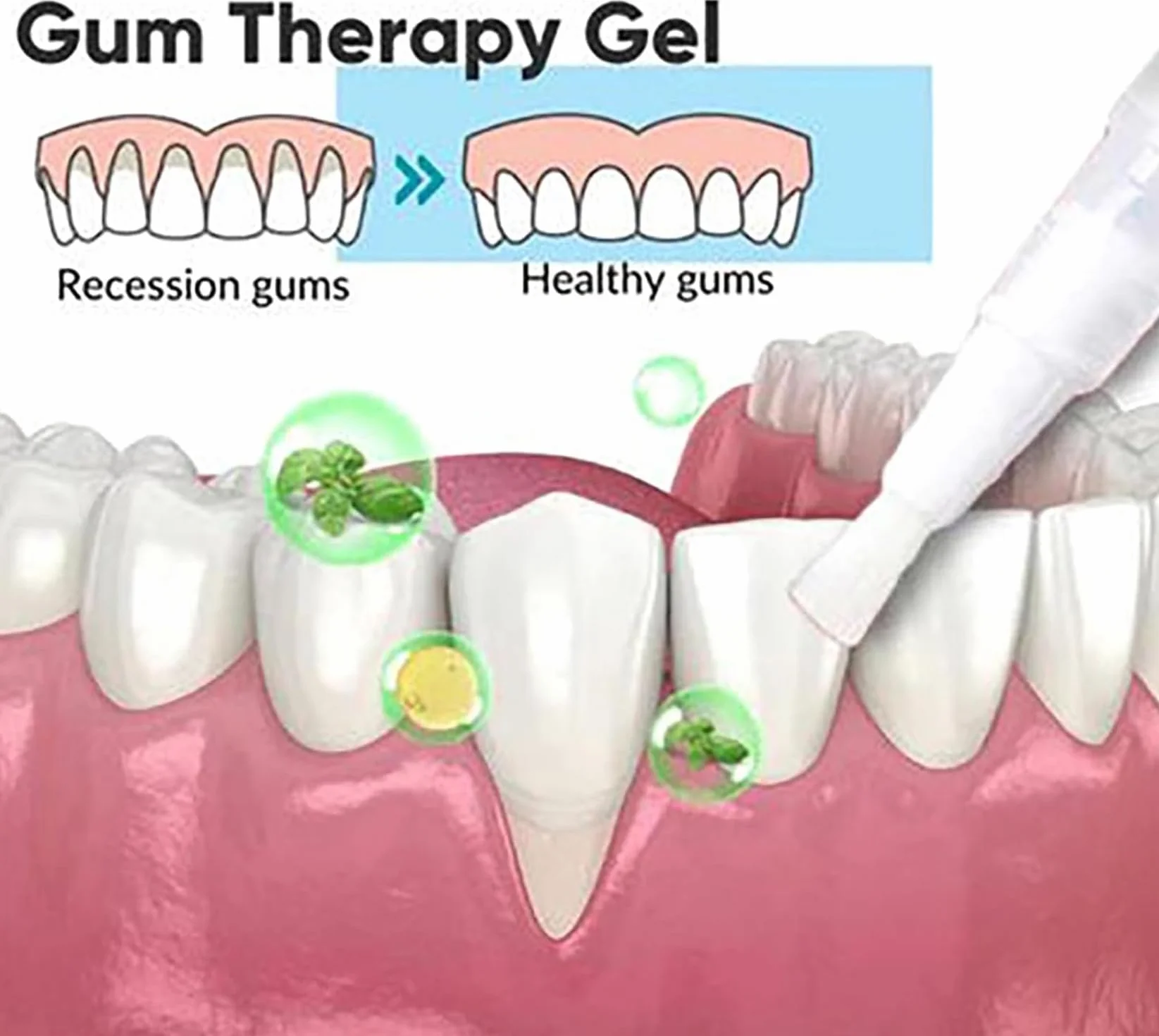 Taileden Gum Therapy Gel per gengive da incasso, gel per la cura delle gengive